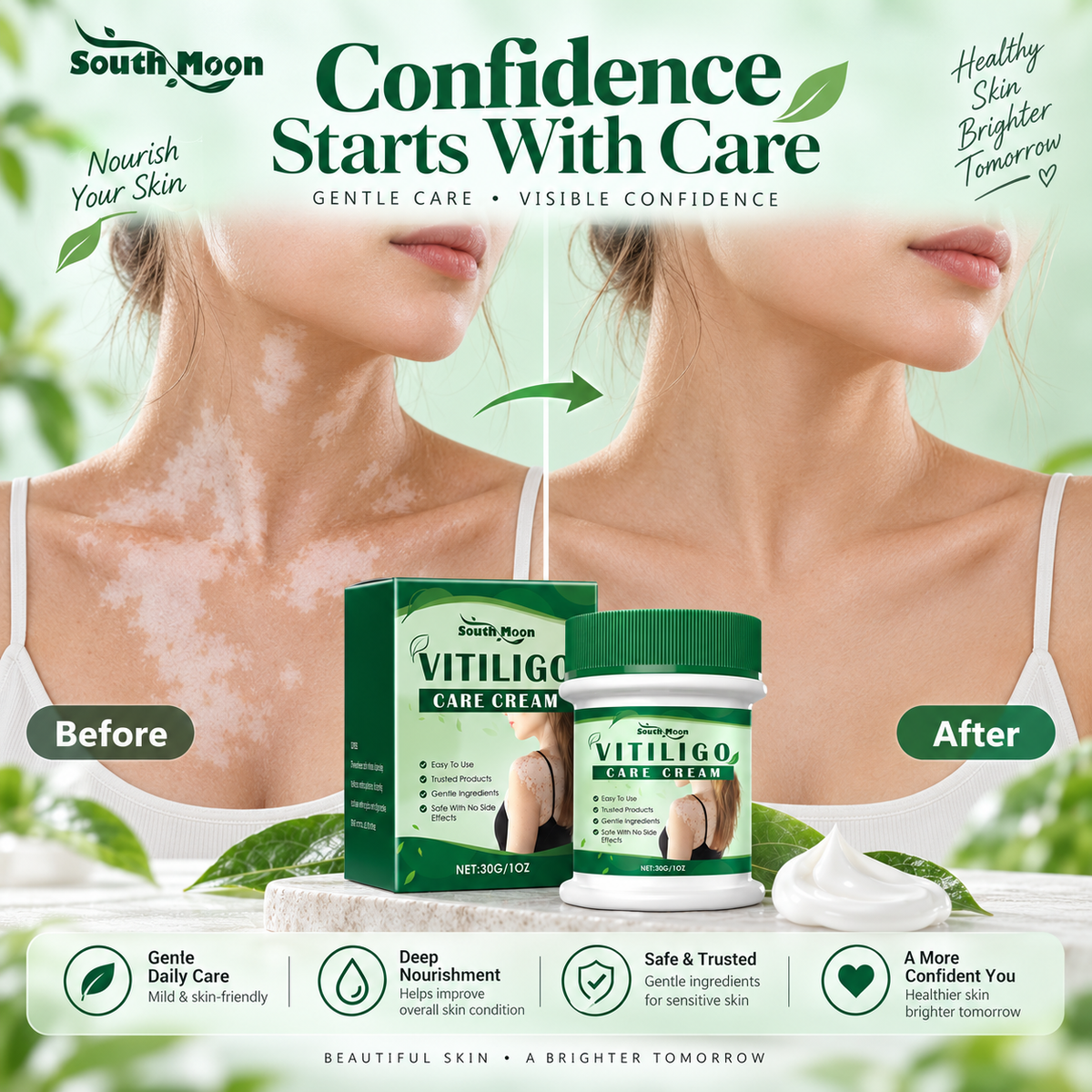 Vitiligo Herbal Aloe Vera & Mint Care Cream