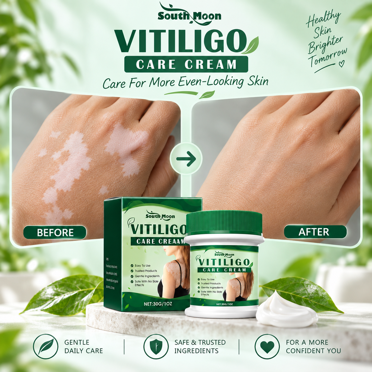 Vitiligo Herbal Aloe Vera & Mint Care Cream