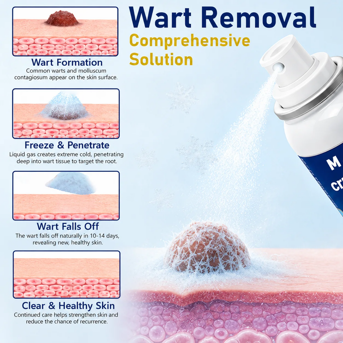 CryoClear Pro Bump Renewal Spray