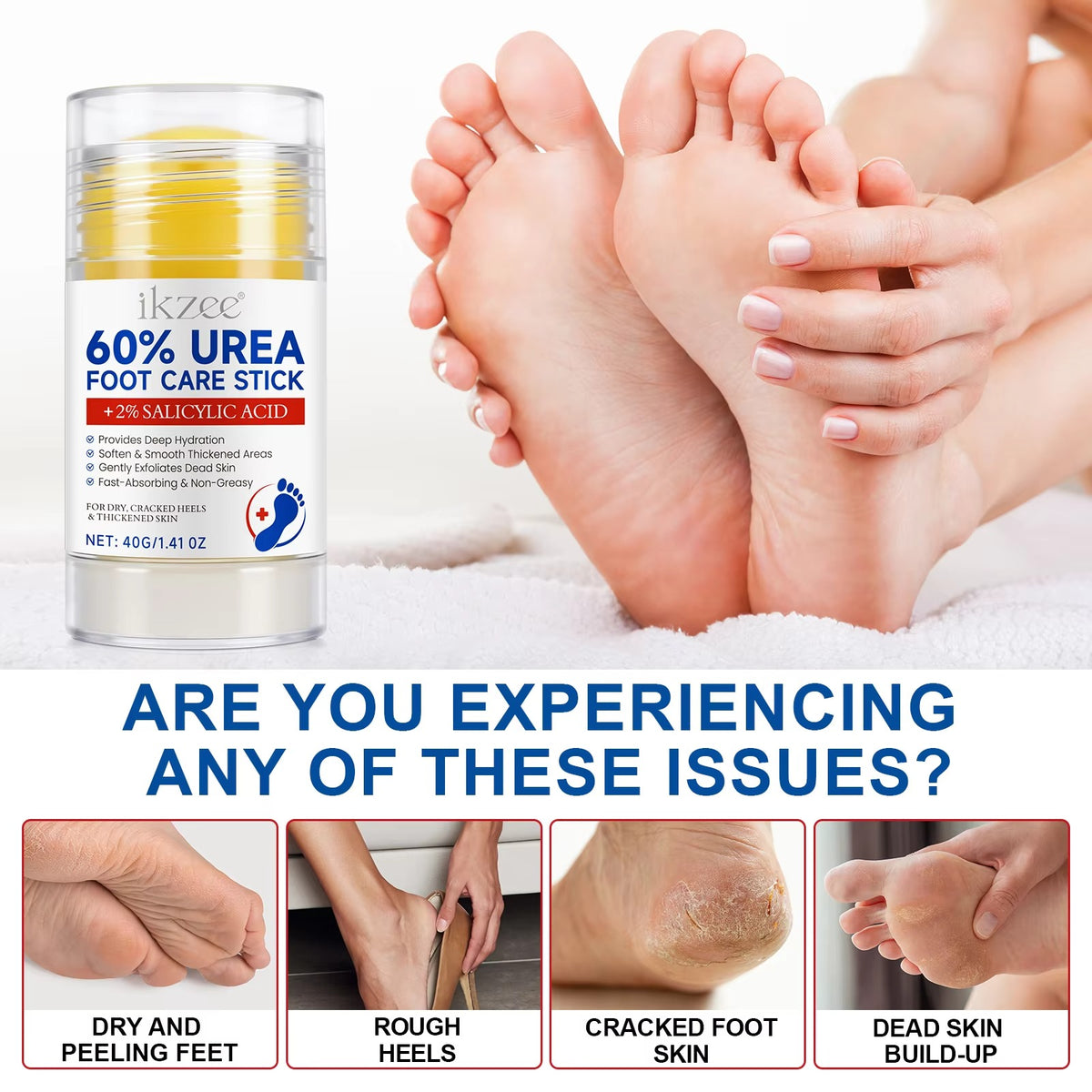 IKZEE 60% Urea Foot Care Stick