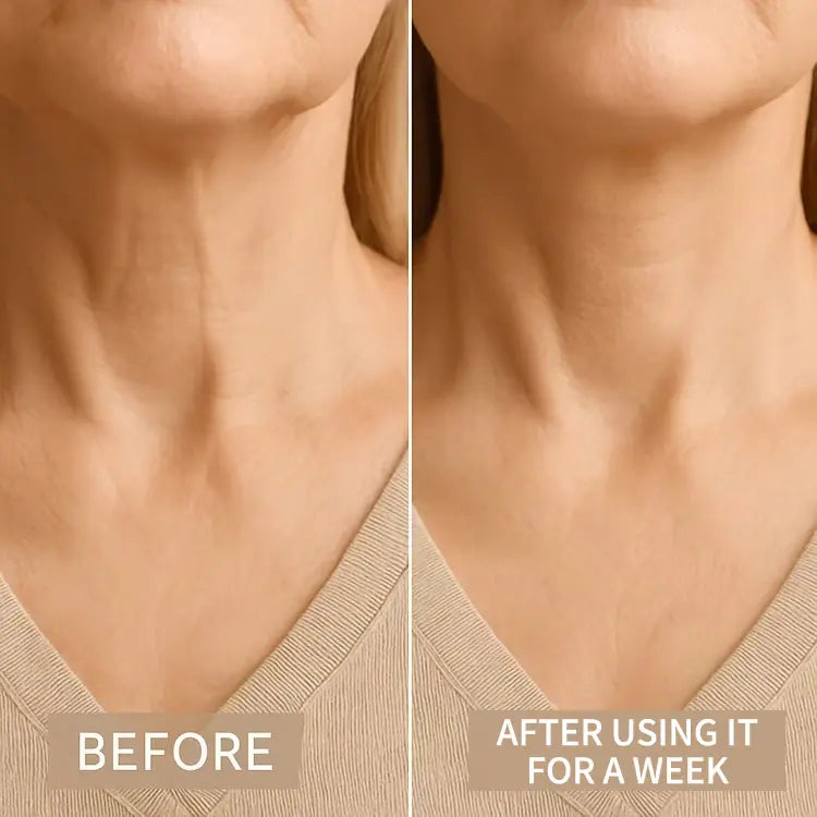 LiftLine  Instant Neck Lift Strips