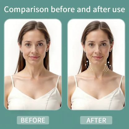 LiftLine  Instant Neck Lift Strips