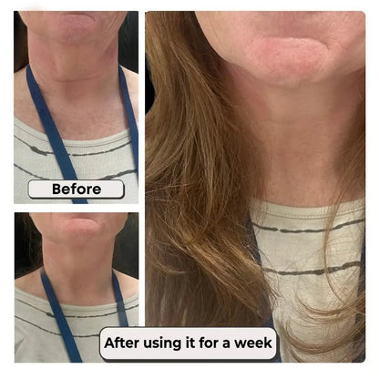 LiftLine  Instant Neck Lift Strips