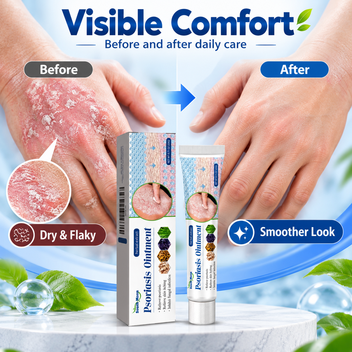 Psoriasis Ointments Sensitive Skin Soothing Care Cream