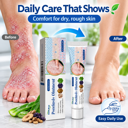 Psoriasis Ointments Sensitive Skin Soothing Care Cream
