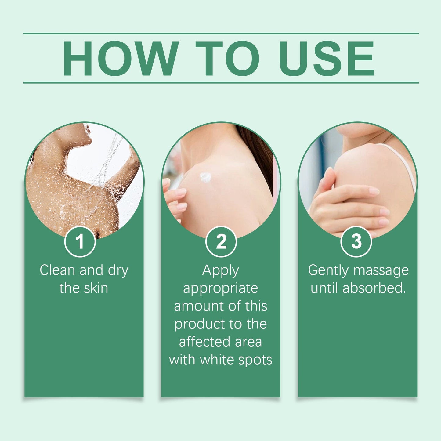 Vitiligo Herbal Aloe Vera & Mint Care Cream