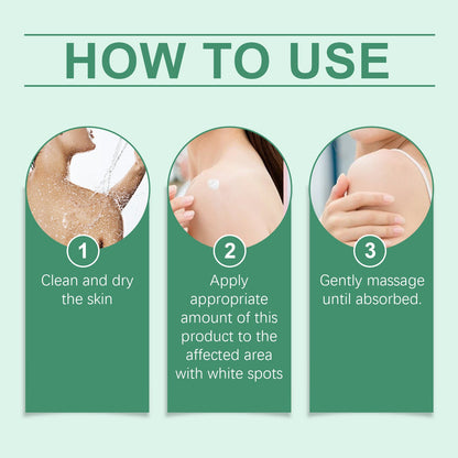 Vitiligo Herbal Aloe Vera & Mint Care Cream