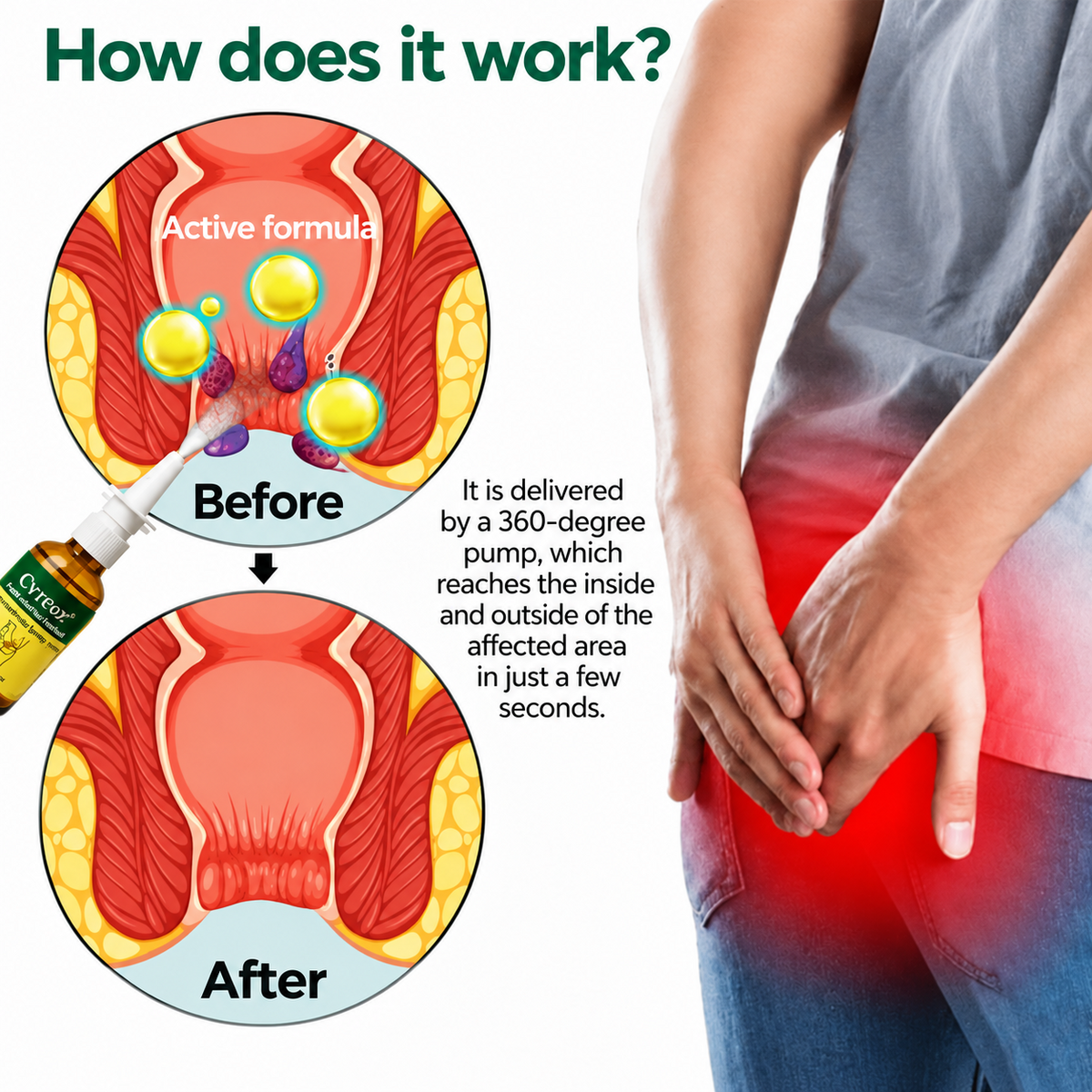 Advanced Comfort Hemorrhoid PRO Spray