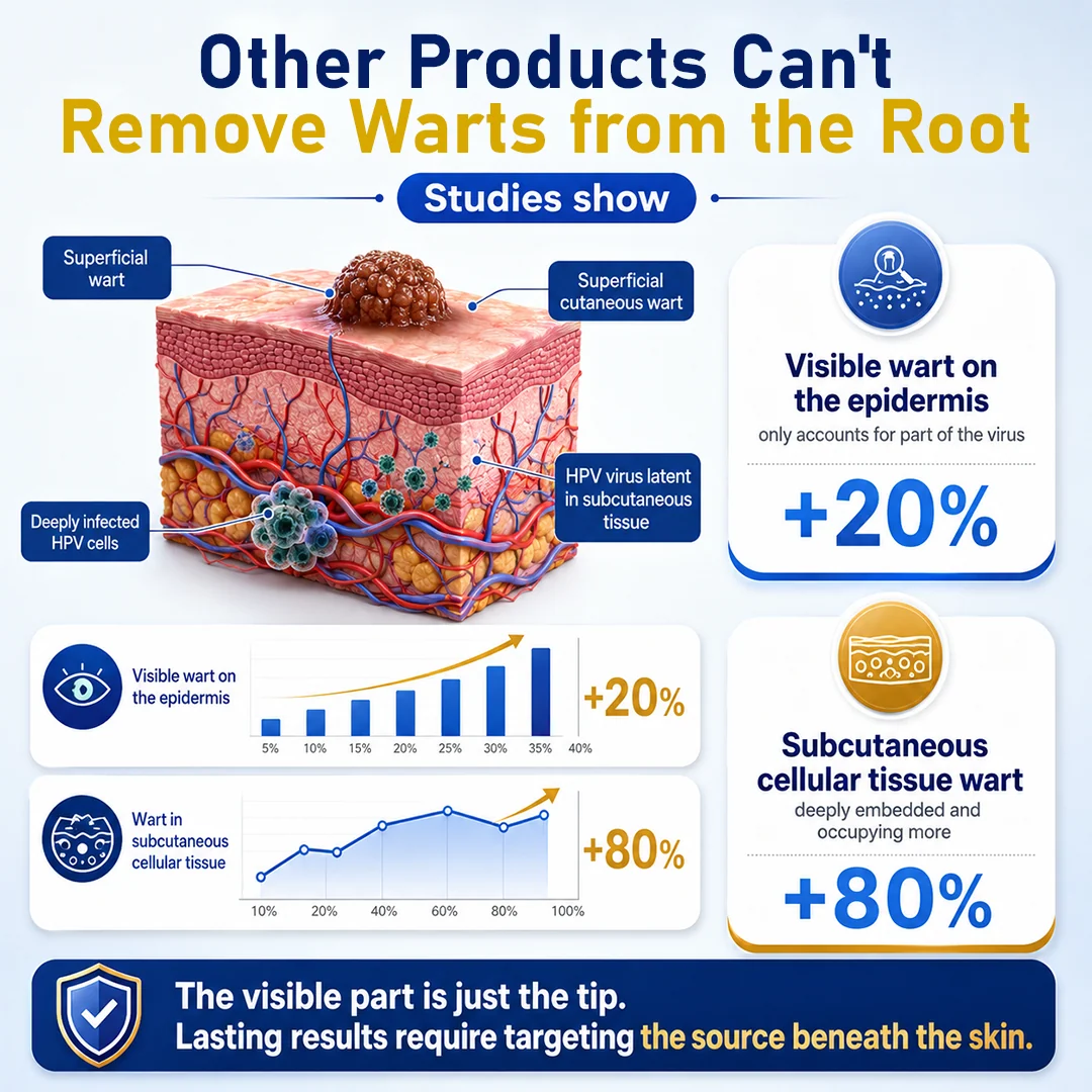 CryoClear Pro Bump Renewal Spray