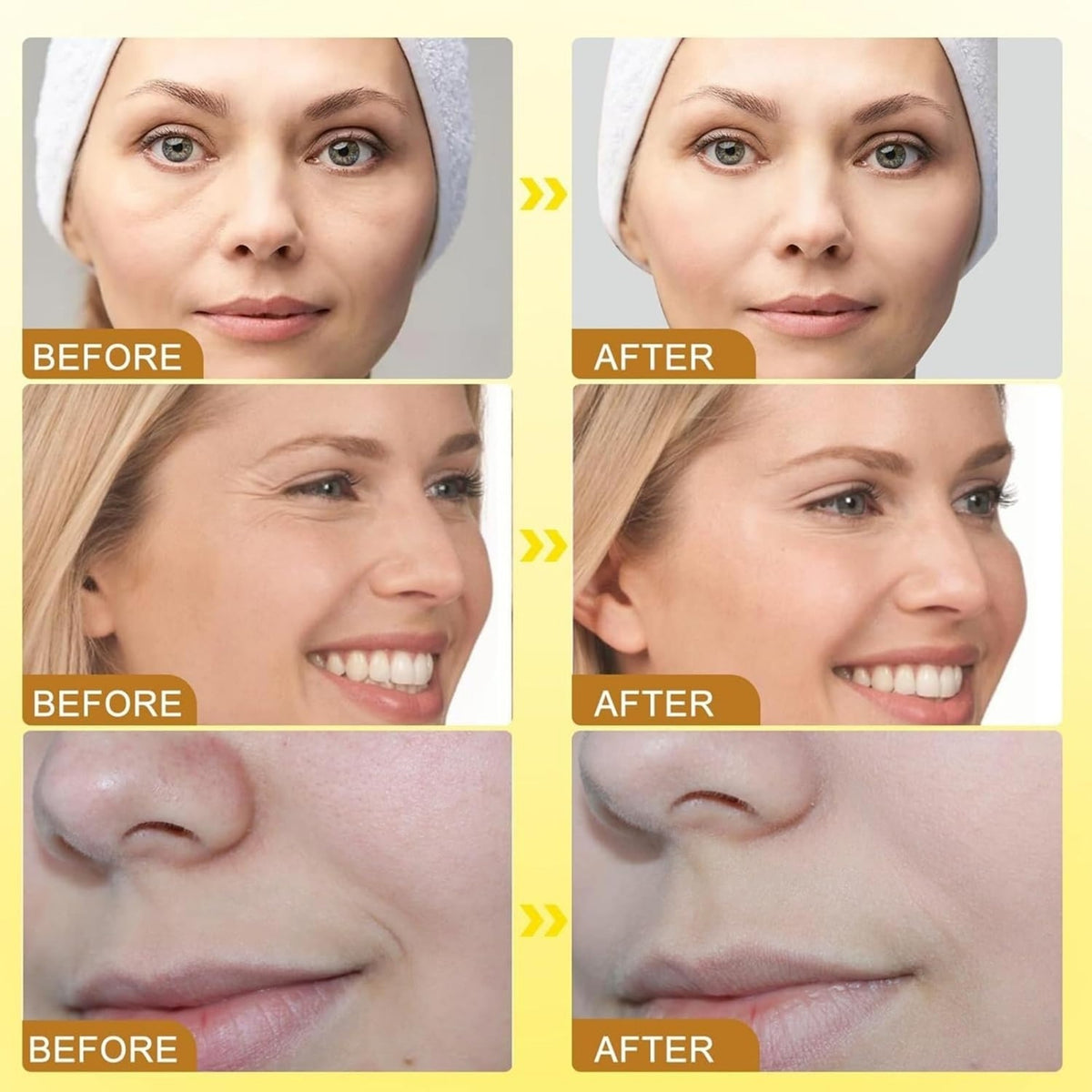 Botox Bee Venom Wrinkle Cream